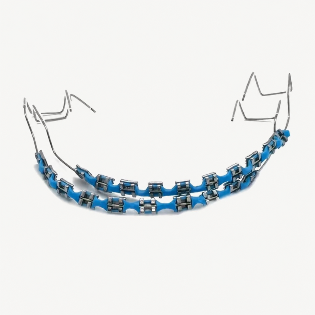 DIY Removable Fashion Braces – Full Set