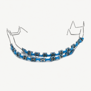 DIY Removable Fashion Braces – Full Set